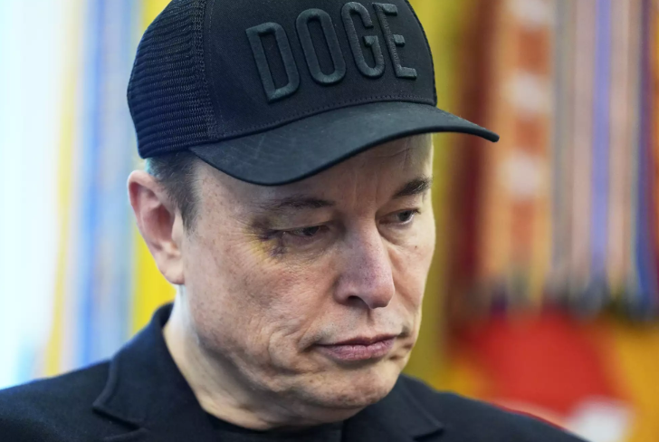 DOGE가 적힌 모자를 쓴 일론 머스크가 2025년 5월 30일(현지시간) 대통령 집무실에서 도널드 트럼프 대통령과 함께 기자 회견에 참석한 가운데 그의 오른쪽 눈 주변이 붓고 보랏빛 멍이 선명했다. / people.com