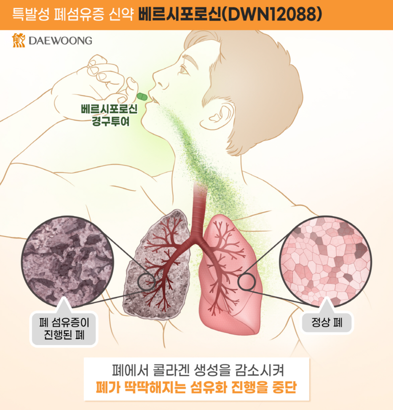 대웅제약 베르시포로신(DWN12088) 작용 기전 / 대웅제약 